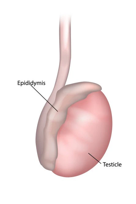 QUISTES DEL EPIDIDIMO