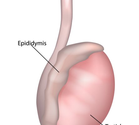 QUISTES DEL EPIDIDIMO